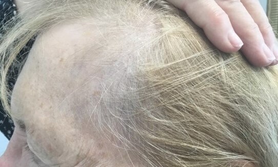 Before Image
