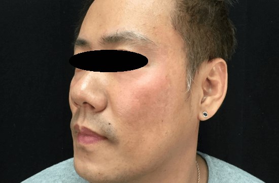 Before Image