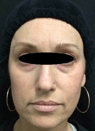 Before Image