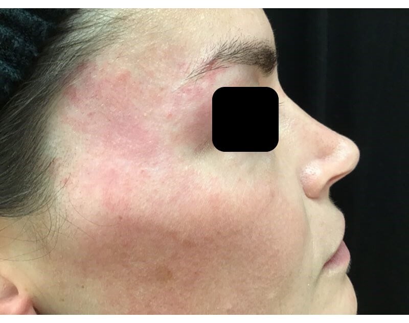 After Image