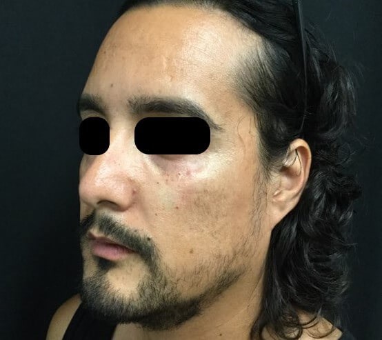 Before Image