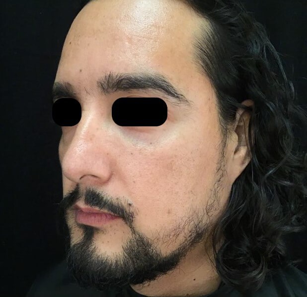After Image