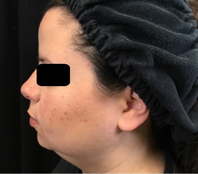 After Image