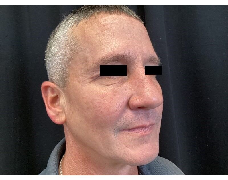 After Image