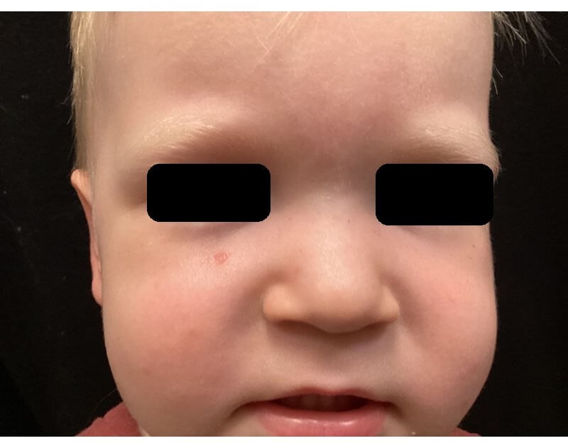 After Image