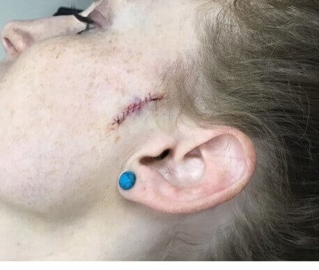 Before Image