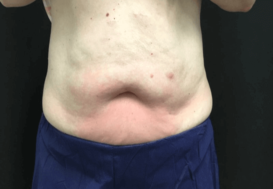 After Image