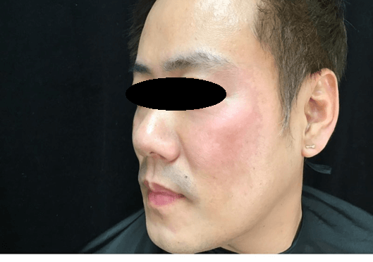 After Image