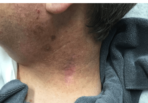 After Image