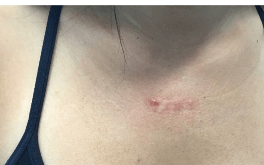 After Image